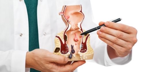 Colonoscopy Treatment | Dr Gaurav Muktesh